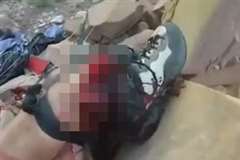 ベースジャンプに失敗し足に大怪我を負ってしまった男性