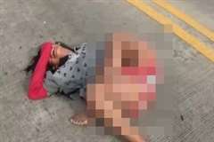 車とスクーターが衝突しスクーターを運転していた少女の足が・・・