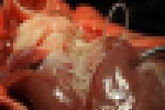 遺体を解剖していたら心臓から大量の寄生虫が・・・