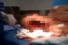 自殺に失敗し？顔が完全に破壊されるもまだ息がある男性