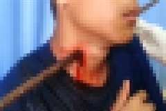 男性の首に突き刺さった鉄筋を除去する手術の映像