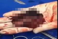 流産で出てきた胎児が手の平の上で動く・・・