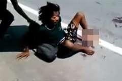 足首から切断された男性が路上で呻く