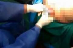 女性の性器と男性の肛門から出てきたありえない物・・・