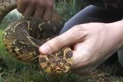 毒蛇「Puff adder(パフアダー)」に手を咬まれた男性
