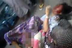 トラックに巻き込まれ左足が潰れた少女