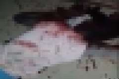 血液が気管に入り不気味な音を立てる呼吸音