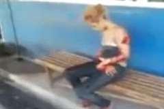 右腕を切断された女性・・・切断された手を持ち自力で病院へ