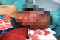 顔が半分吹き飛ばされてもまだ息がある男性