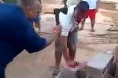 泥棒を働いた男性の指を斧で切断する