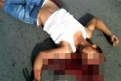 バイク事故で頭が割れ脳が丸ごと飛び出す