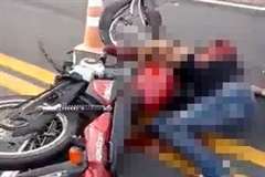 バイク事故で腕が引きちぎられた男性