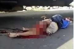 トラックとバイクが衝突し足が切断されたライダー