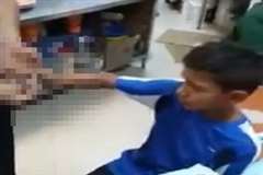 変な場所からグニャリと曲がっている少年の腕を正常な状態に修復する男性の映像