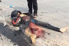 バイク事故で足を酷く損傷しているライダー