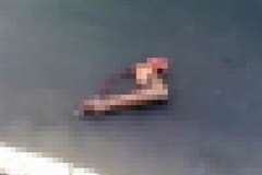 路上に倒れているライダーの腕が切断されている