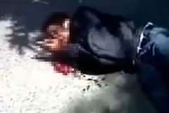 バイク事故で目玉が飛び出した男性