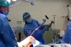 手術中に患者の膝から抜けなくなった器具をハンマーで叩いて無理やり抜き取る